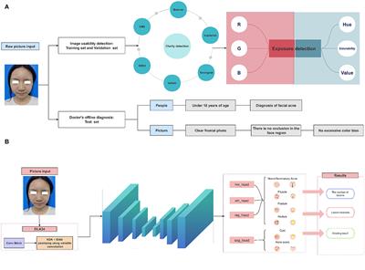 Advancements in acne detection: application of the CenterNet network in smart dermatology